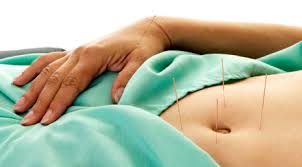 acupuncture infertility treament