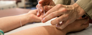 acupuncture treatment for hand