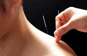 Palmers green massge-acupuncture treatment